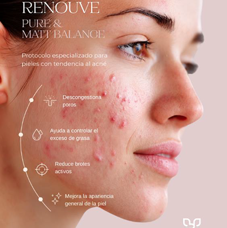 Renouve Pure & Matt Balance